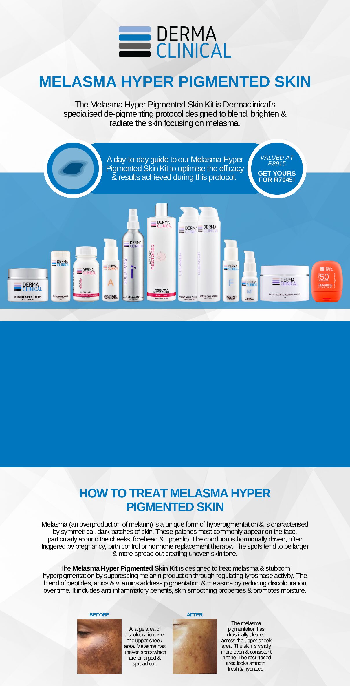 MELASMA HYPER PIGMENTED SKIN PACK - Image 4