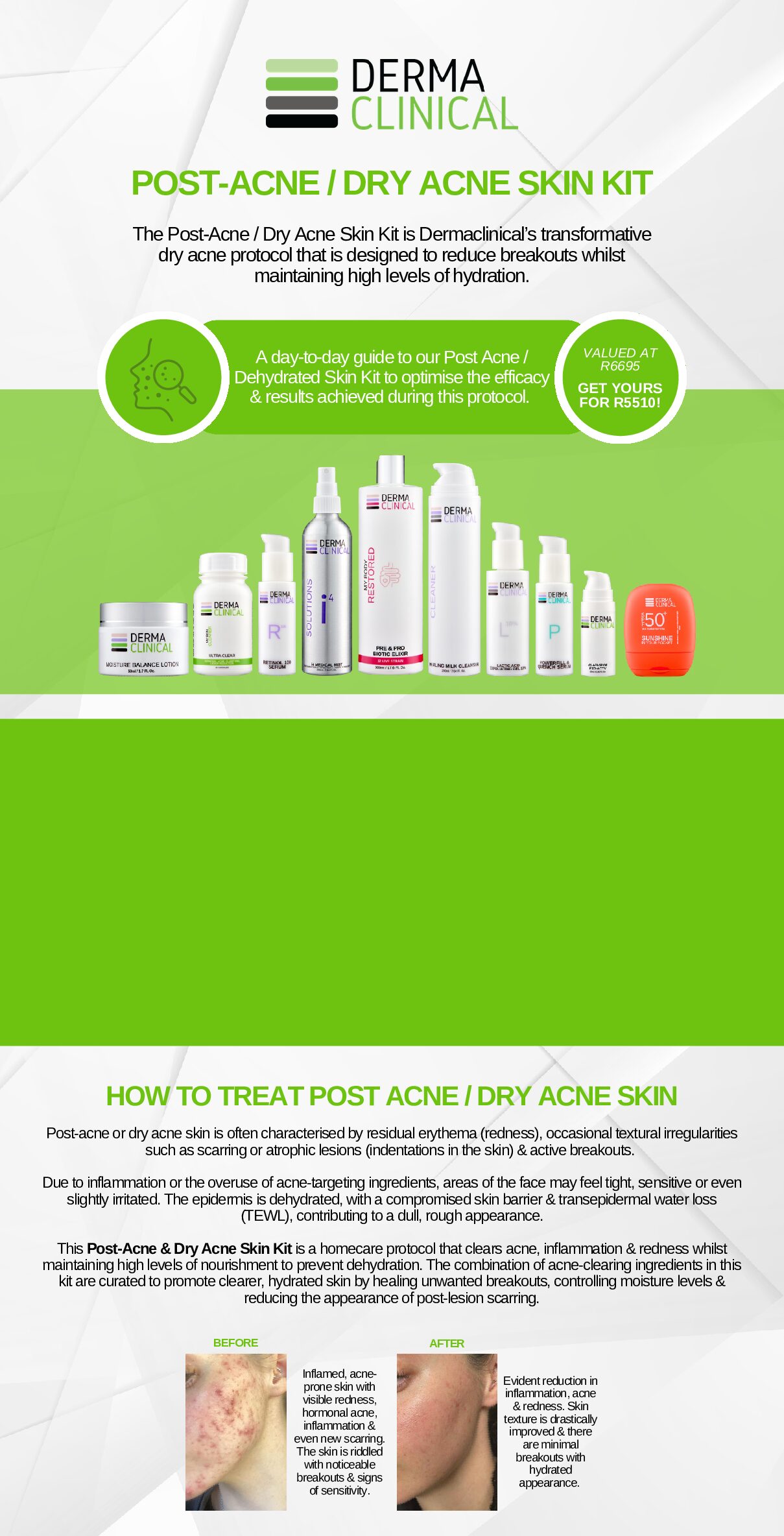 POST-ACNE / DRY ACNE SKIN PACK - Image 4